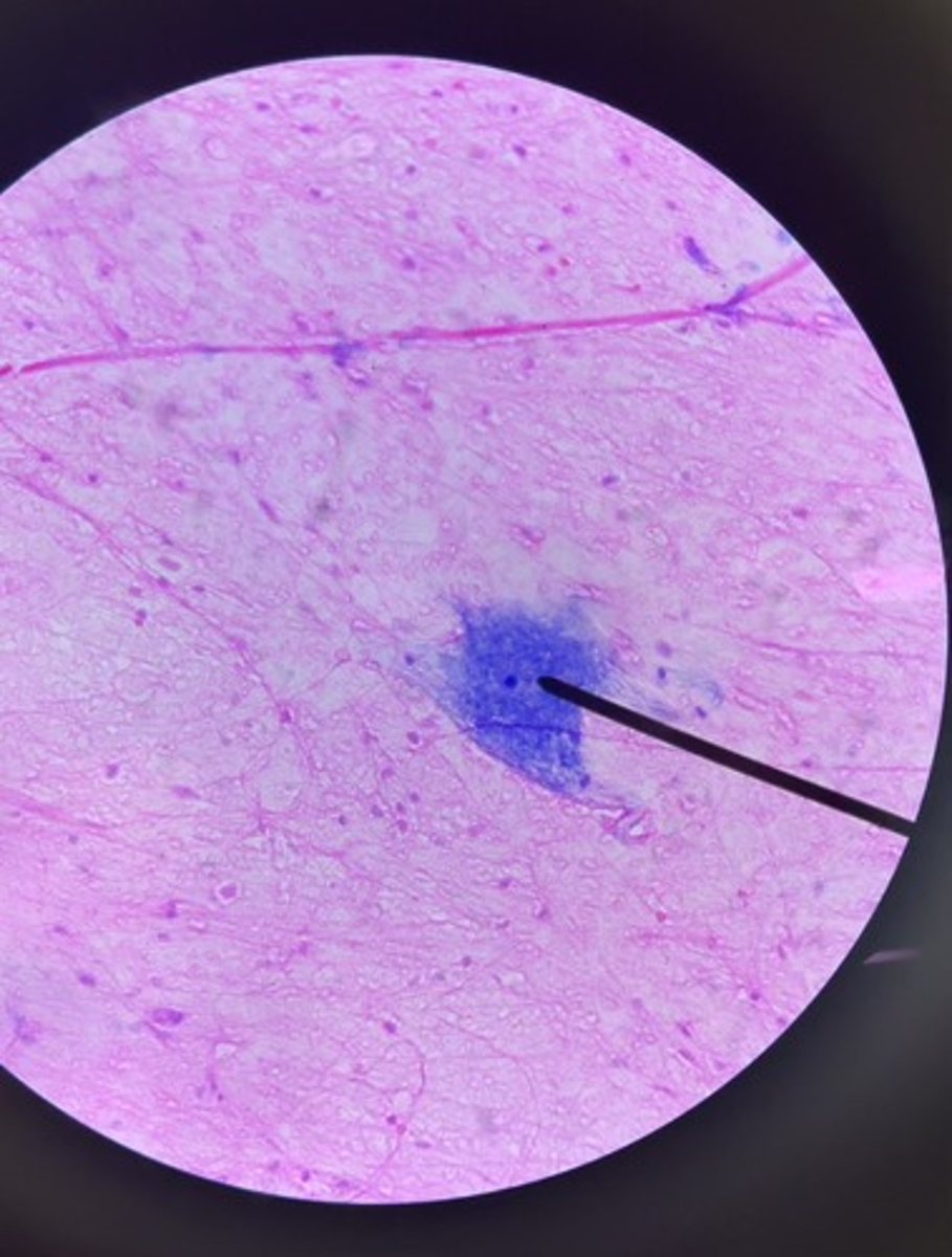 <p>1. What type of cell is seen at the pointer?</p><p>2. What type of cell is seen surrounding the cell at the pointer (smaller blue dots)?</p>