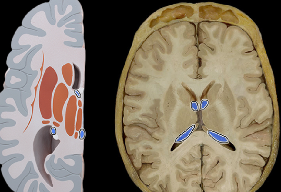 <p>Location:</p><ul><li><p>Lateral, third, and fourth ventricles of brain</p></li></ul><p>Description:</p><ul><li><p>Tufts of capillaries covered by specialized ependymal cells that line ventricles</p></li></ul><p>Function:</p><ul><li><p>Specialized ependymal cells produce cerebrospinal fluid</p></li></ul><p></p>