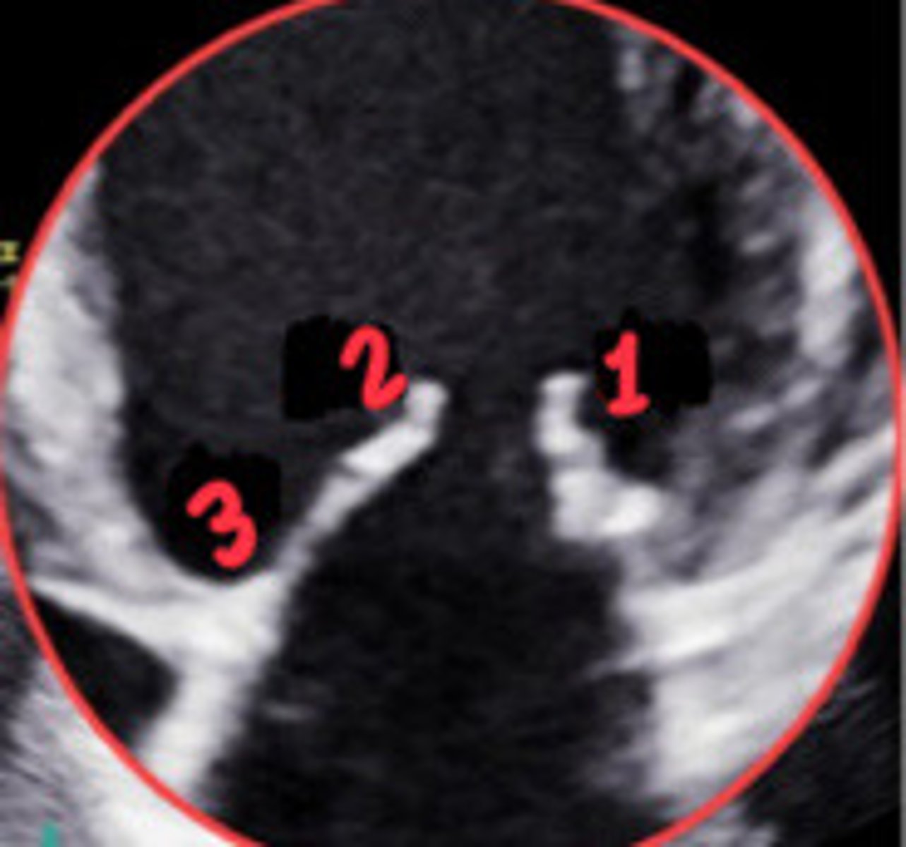 <p>What section of the MV is 3</p>