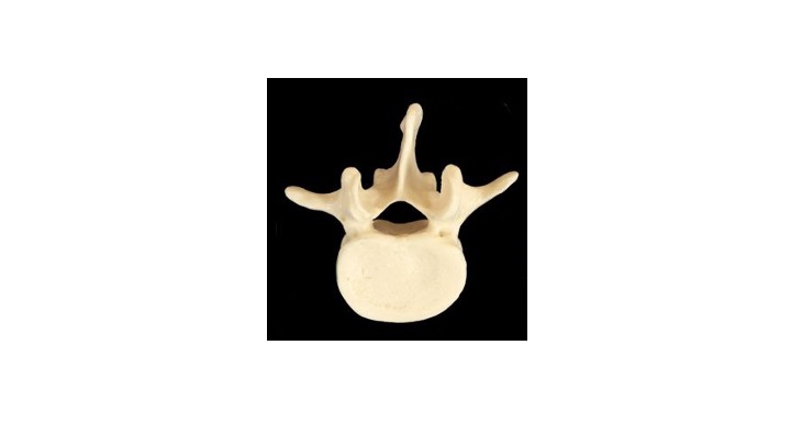 <p>What type of bone marking is this? (Hint: it’s a projection aka a what?)</p>