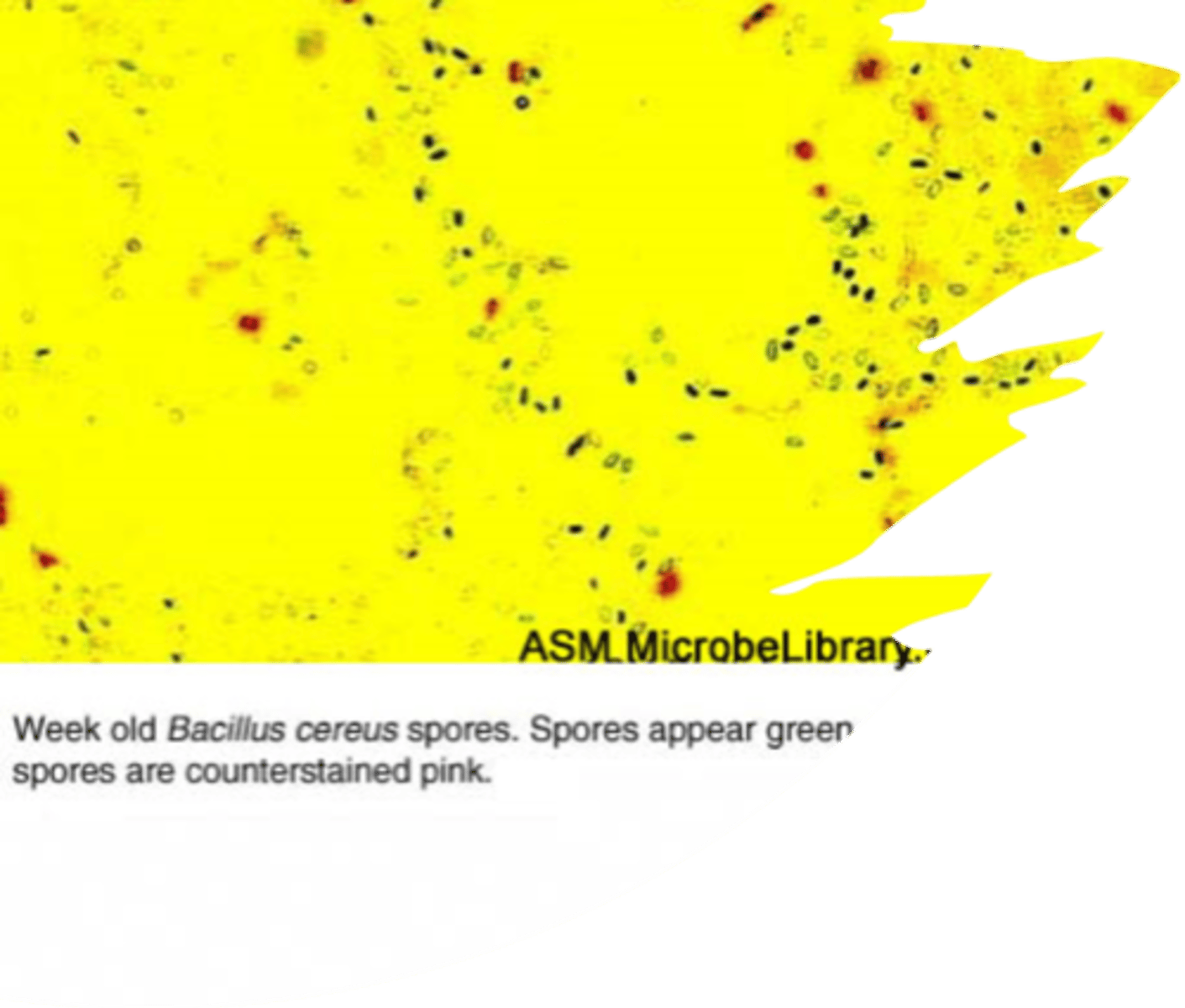 <p>Bacillus food poisoning is associated with which foods?</p>