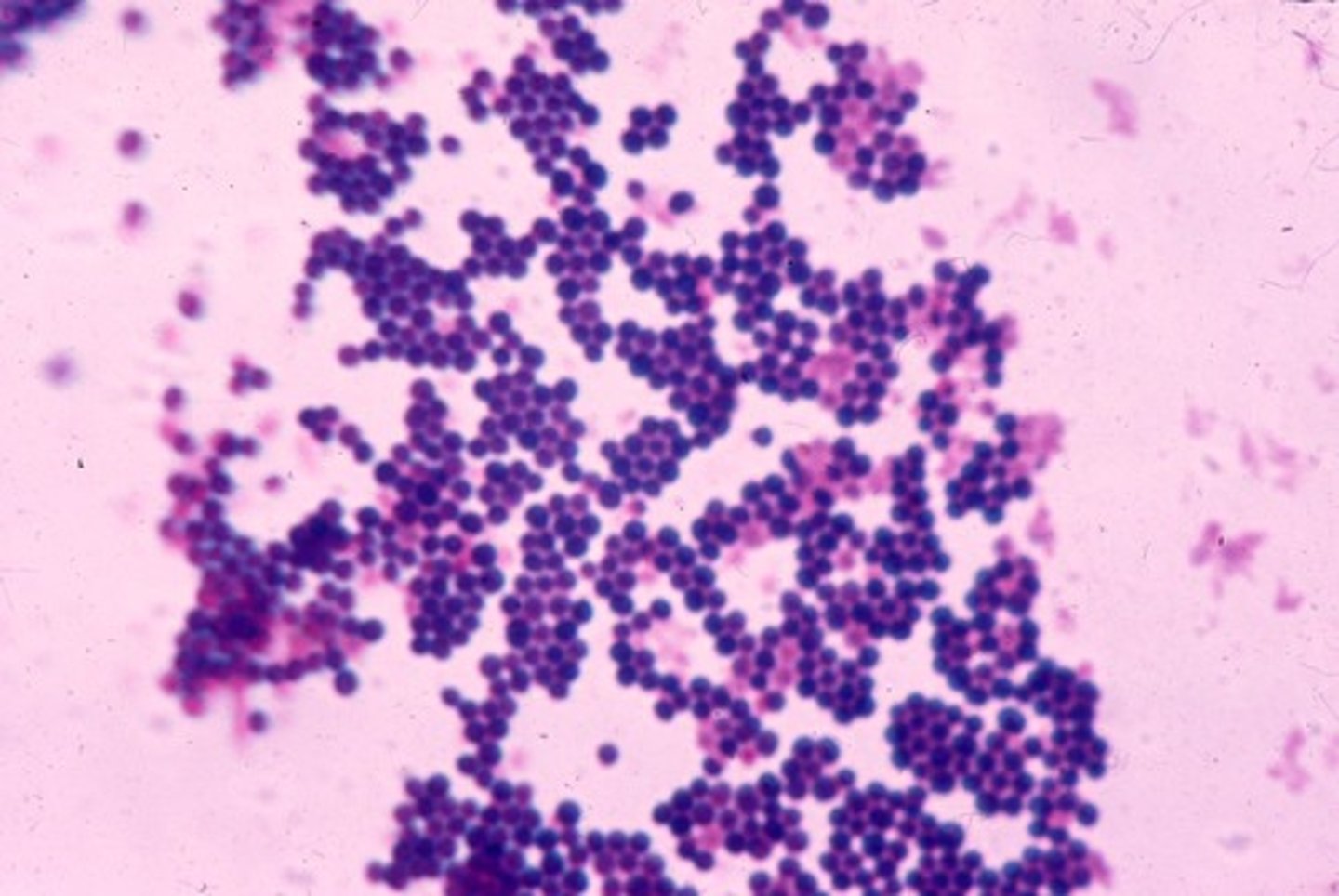 <p>A bacterium that occurs as clusters of cocci</p>