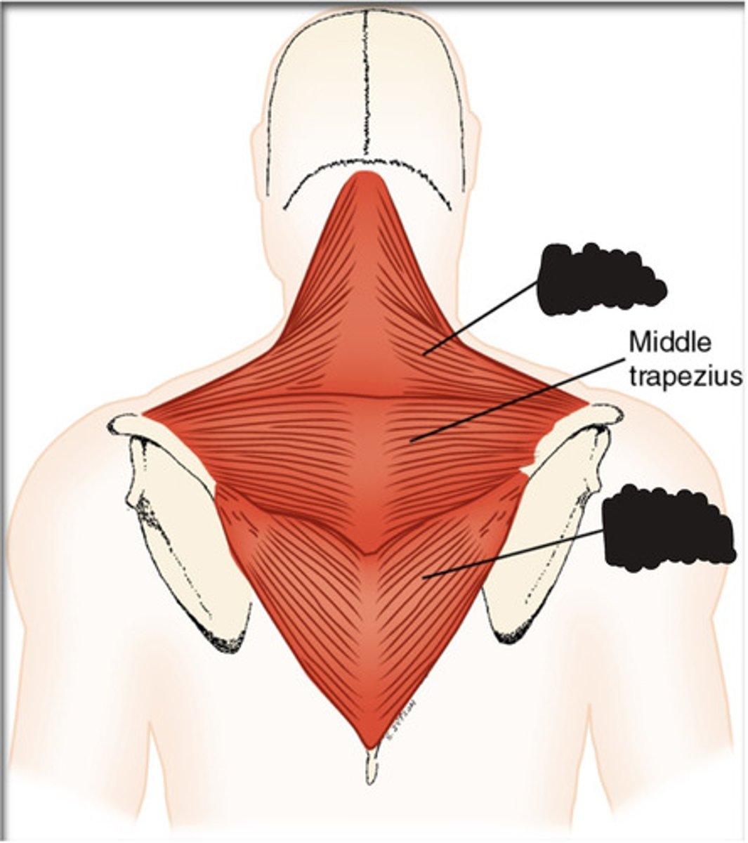 <p>What muscle is this?</p>