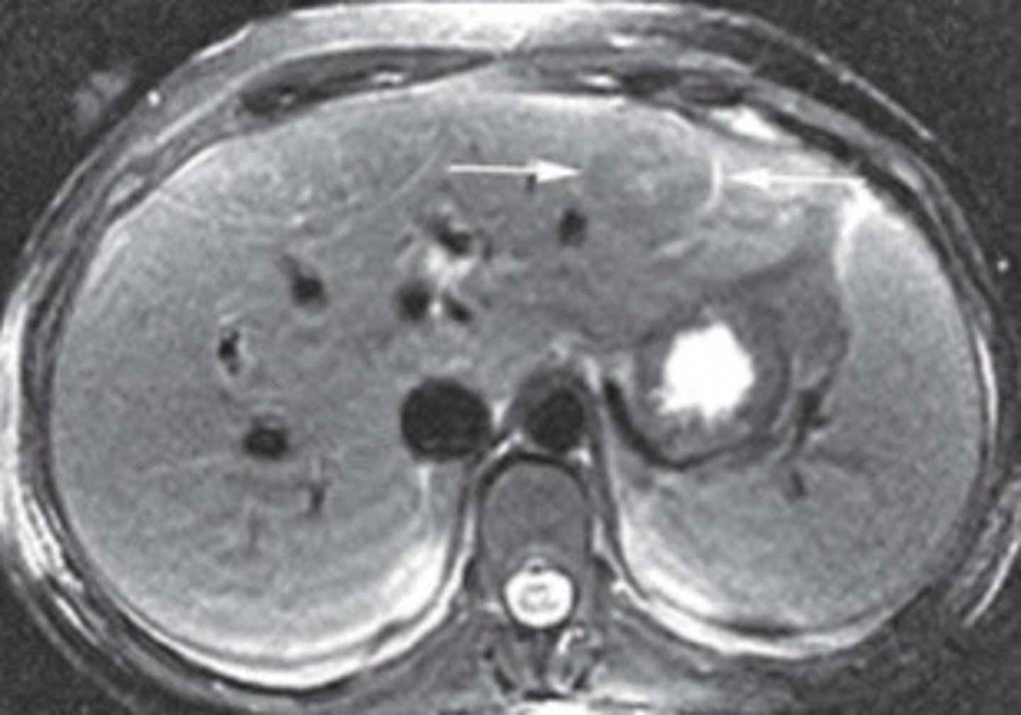 <p>What are the arrows pointing to</p>