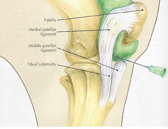 <p>what is desensitized with a femoropatellar joint block</p>