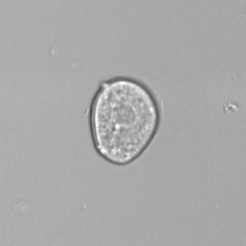 <p>cuboidal, significant pathology</p>