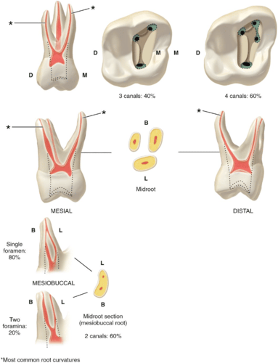 <p>maxillary first molar access shape</p>