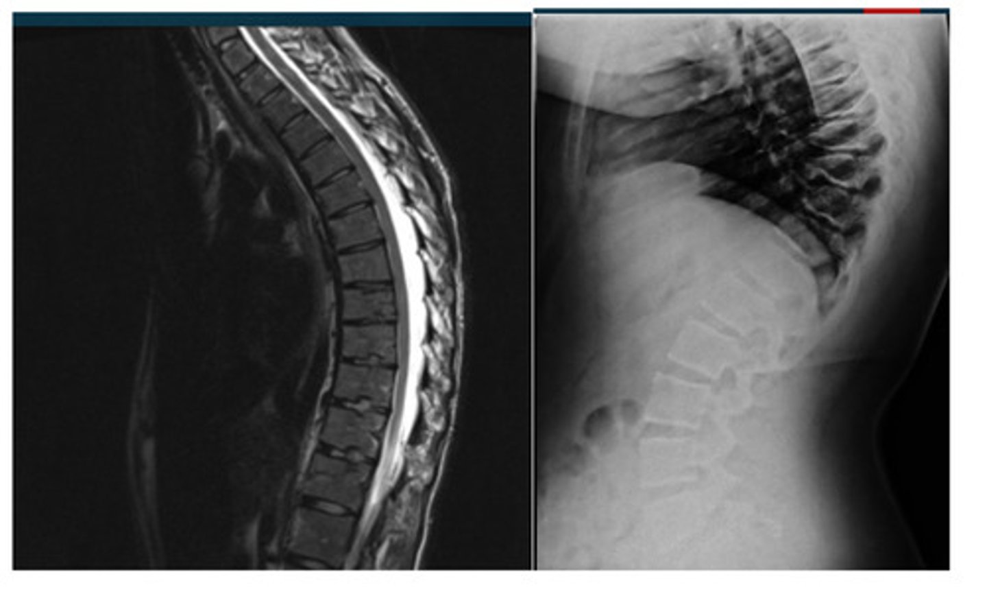 <p>What abnormality is this?</p>