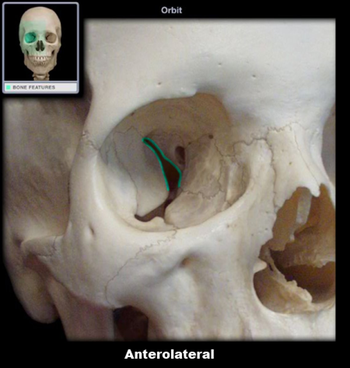 knowt flashcard image