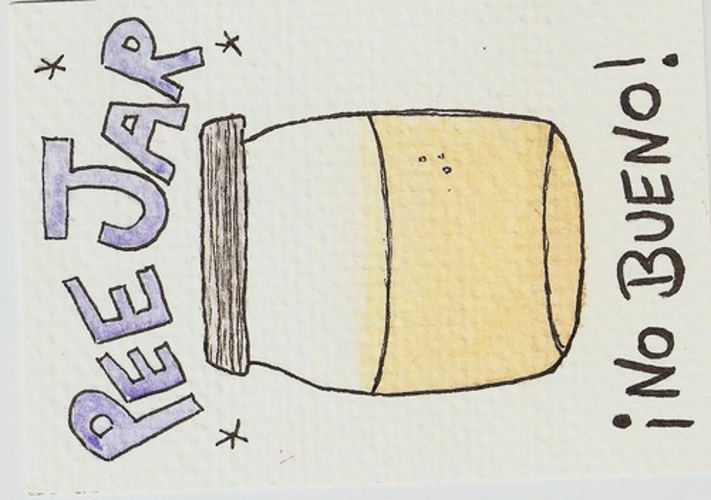 <p>Unconjugated bilirubin + glucuronic acid --> water soluble --> excreted in urine and bile</p>