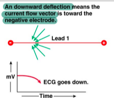 <p>electrical activity is moving away from the positive electrode</p>