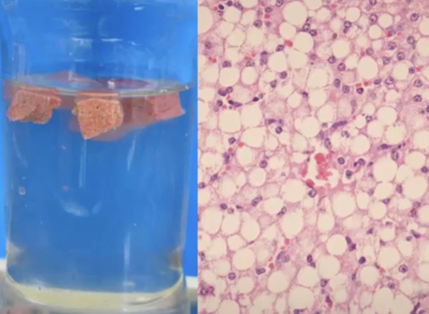 <p>What has caused this gross and histologic lesions?</p>