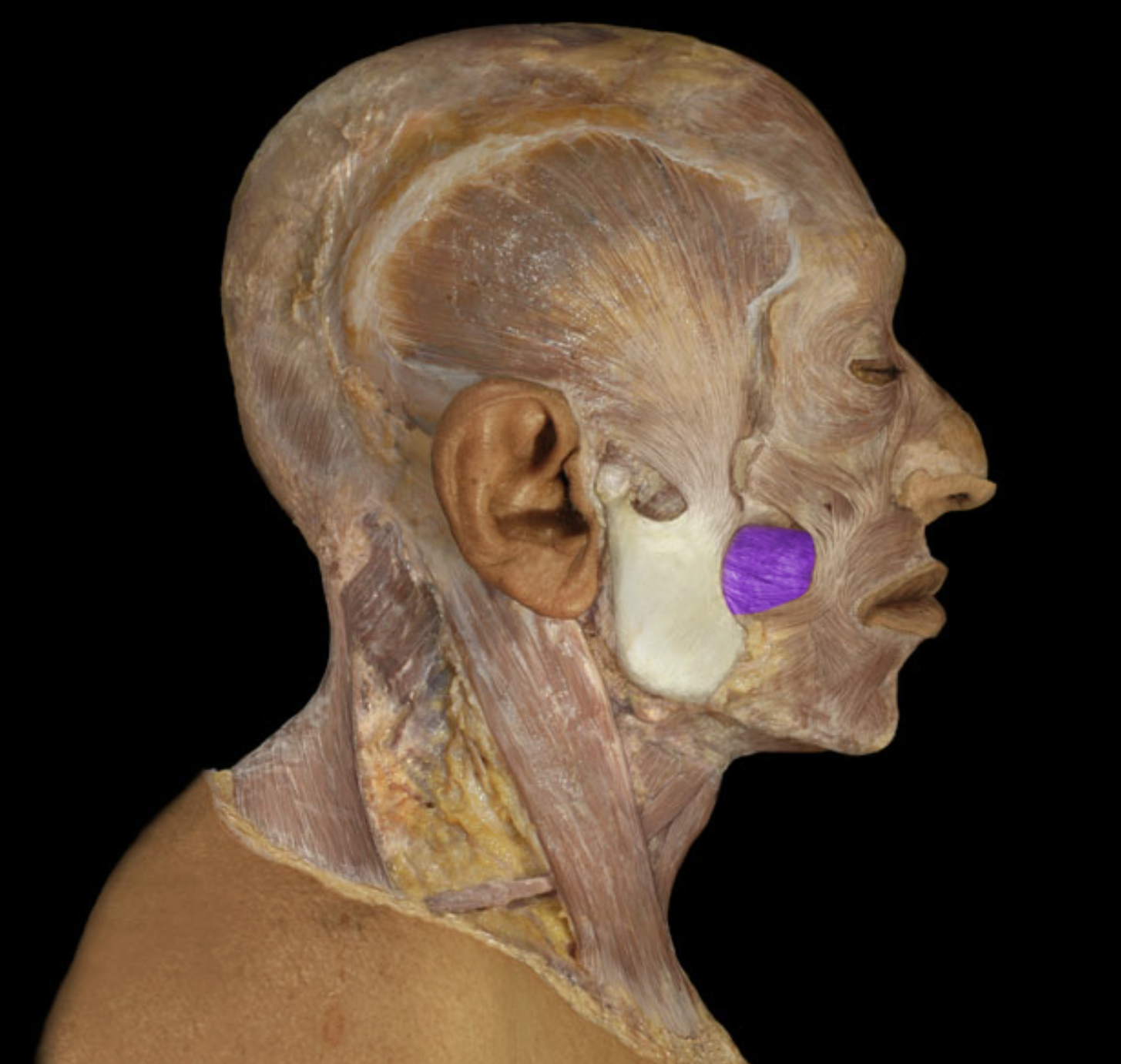 <p>What muscle is this?</p>