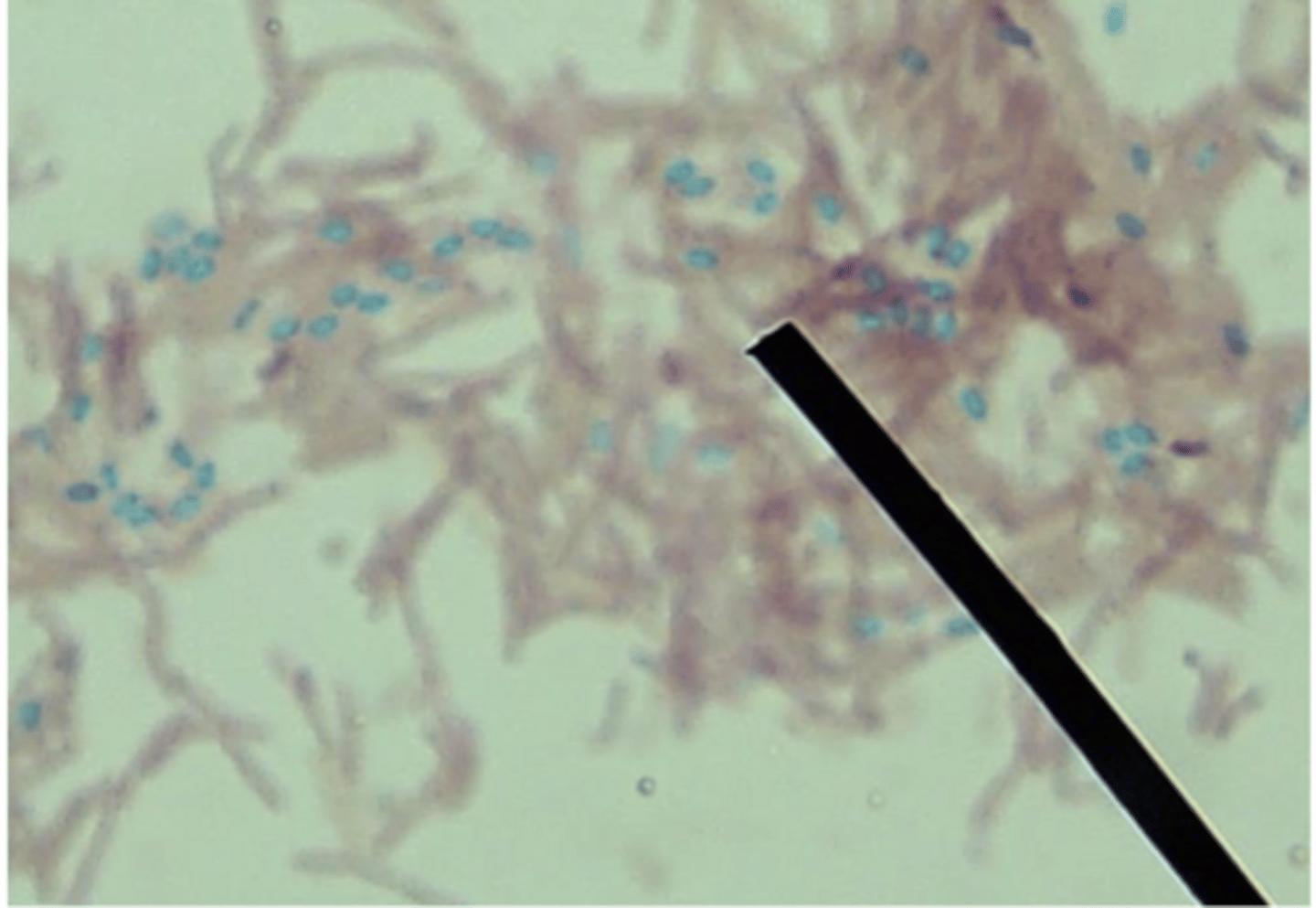 <p>- bacillus</p><p>endospores = blue/green</p><p>cell bodies = pink</p>