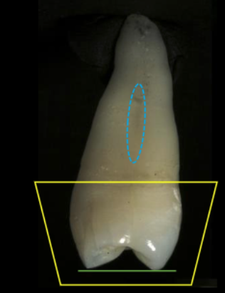 <p>shallow developmental groove</p>