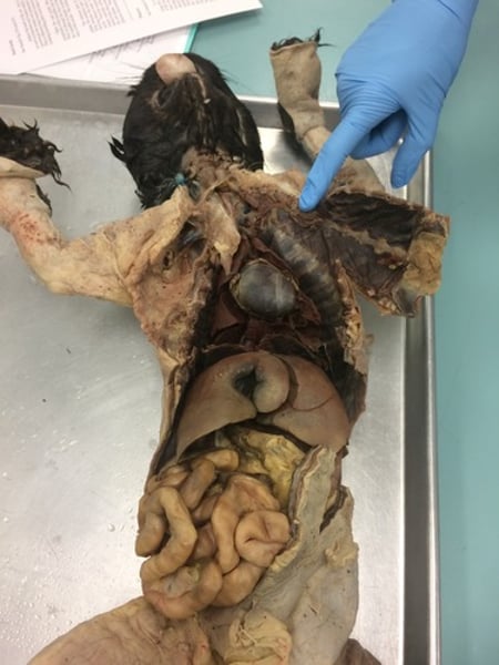 <p>body cavity</p>