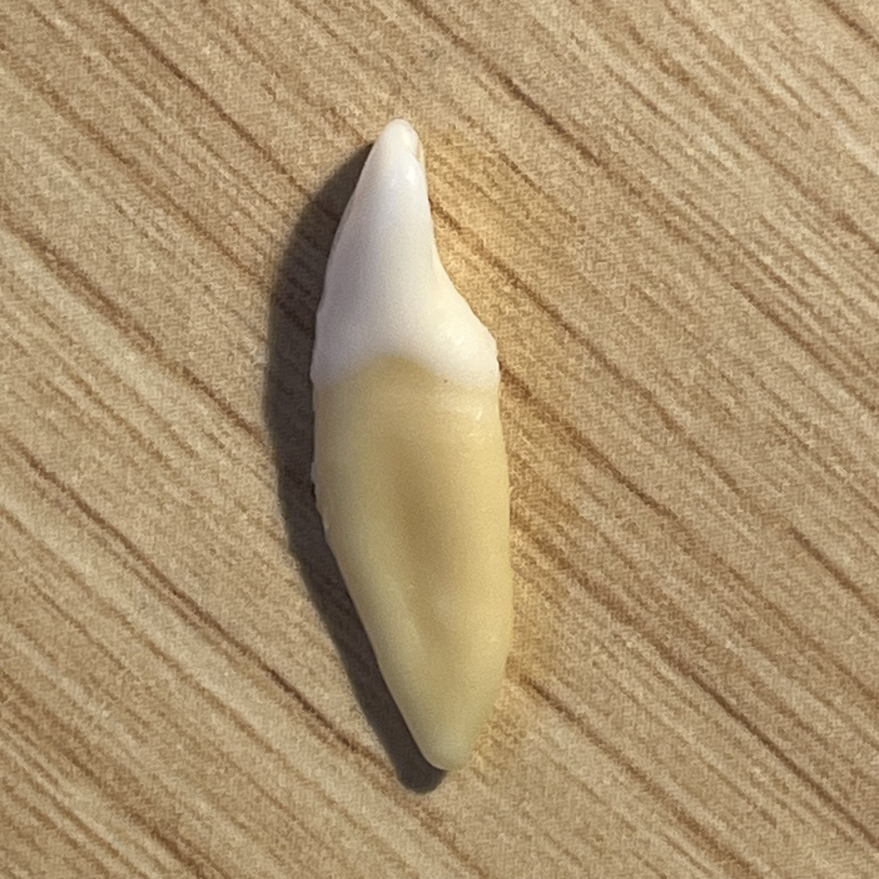 <p>What tooth is this (with view)?</p>