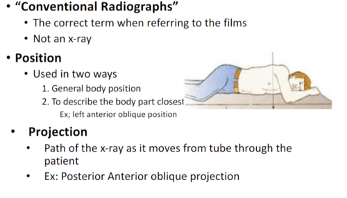 <p>Path of the x-‐ray as it moves from tube through the patient</p><p>•Ex: Posterior Anterior oblique projection</p>