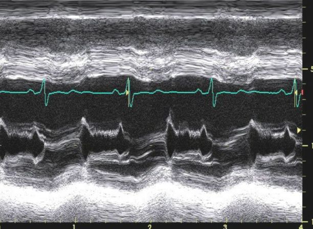 <p>what is this showing</p>