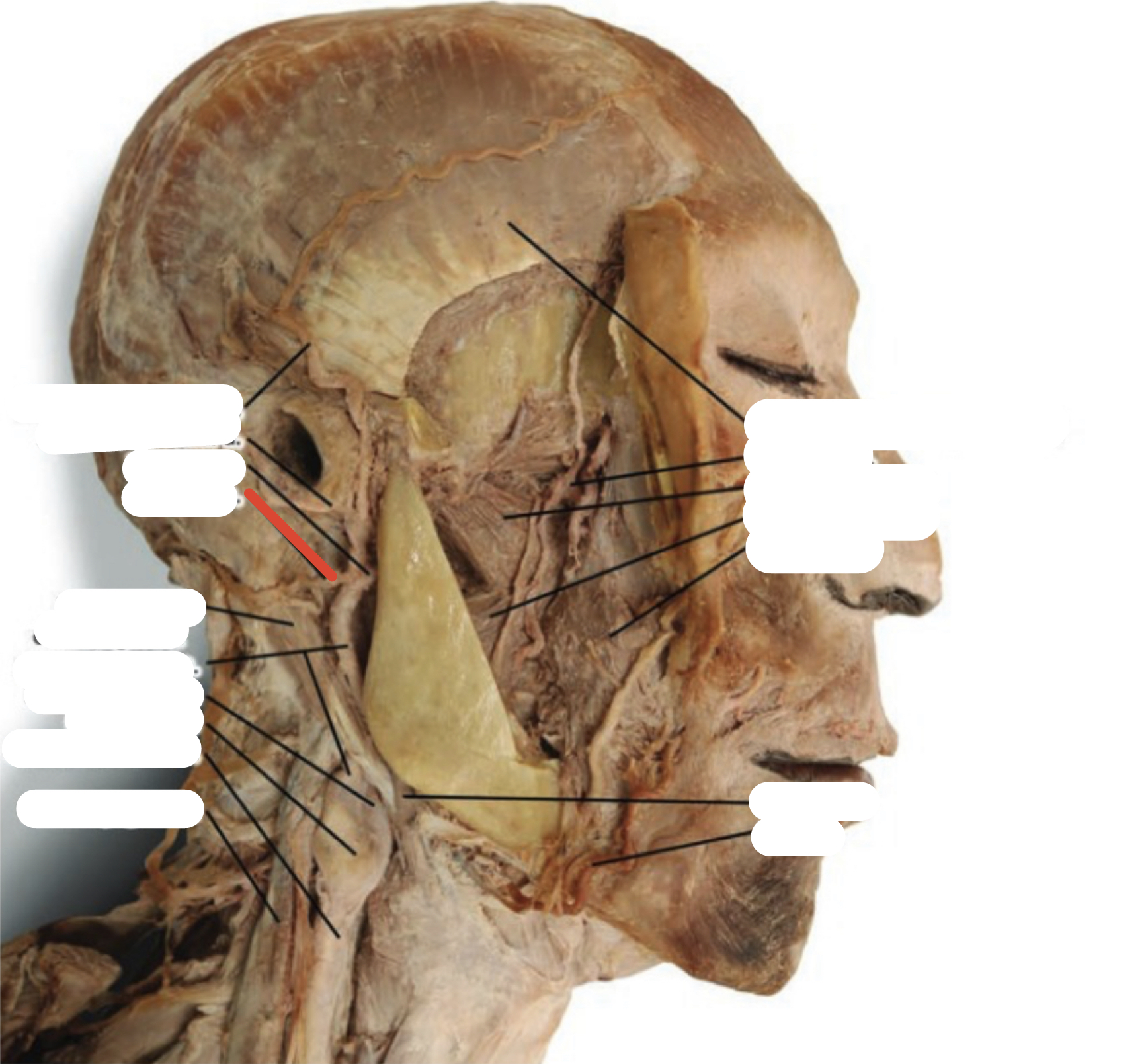 Identify the structure (red line)