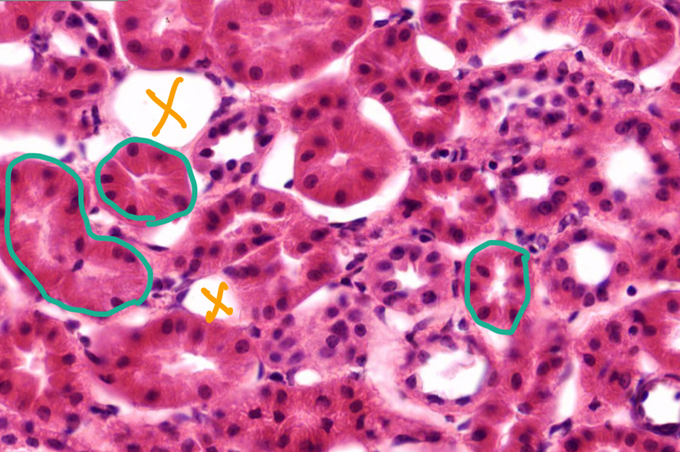 <p>What’s in green?</p>