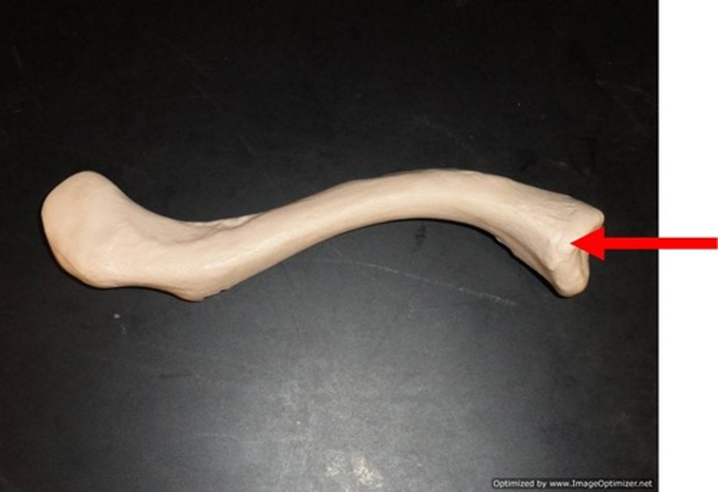 <p>Name the structure</p>