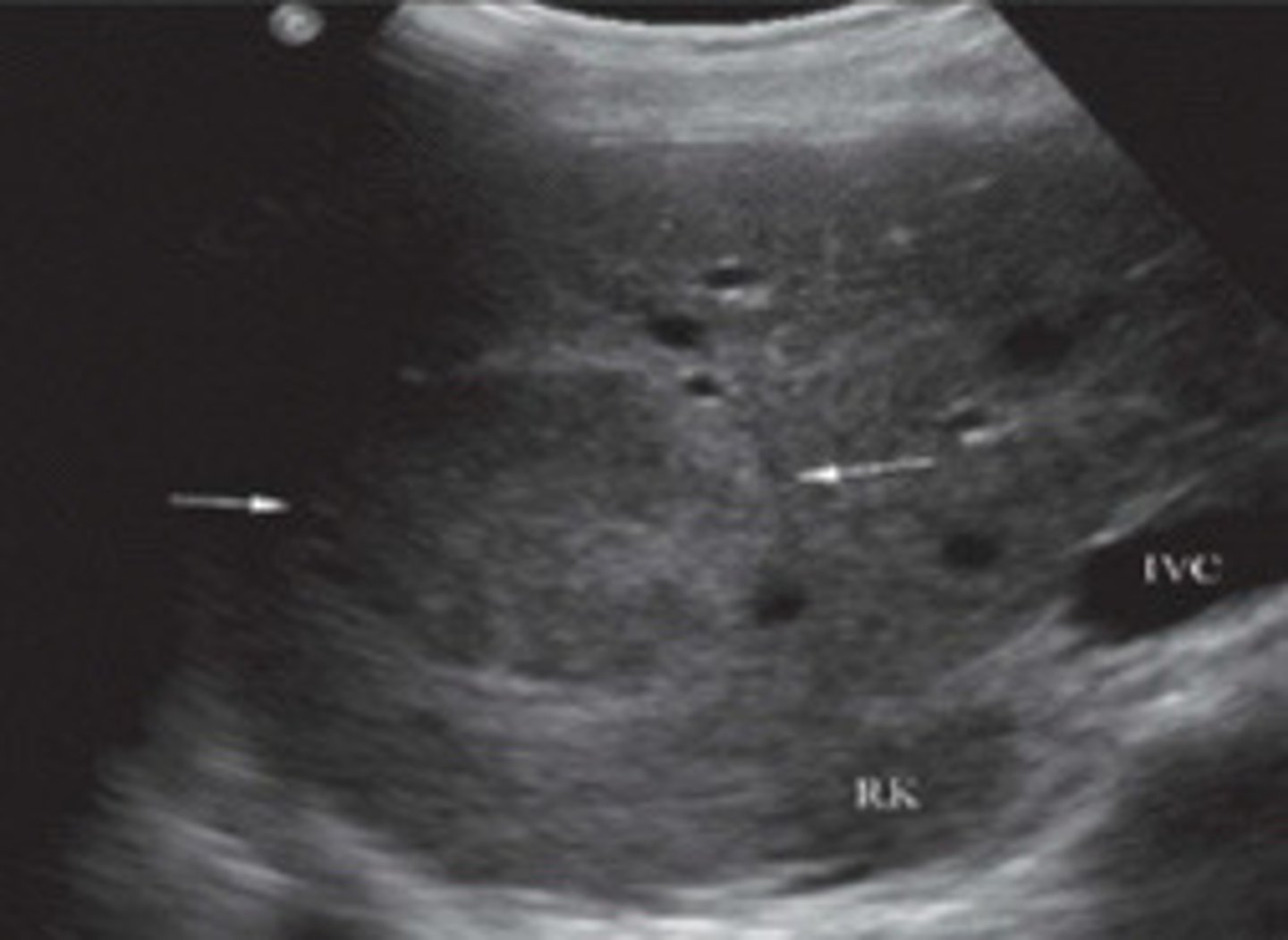 <p>What does this image show</p>