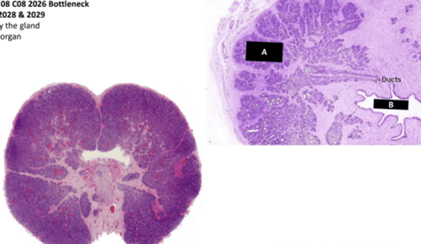 <p>organ</p>