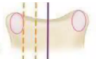 <p>identify nash-moe grade</p>