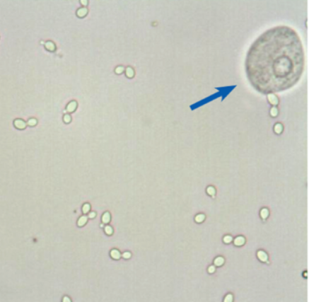 <p>name this cell (blue arrow), what is it associated with?</p>