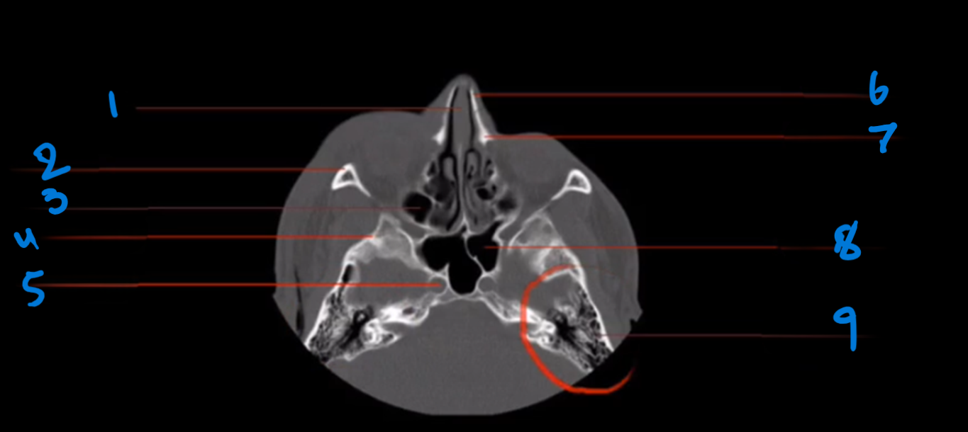 <p>What is the landmark #1 called?</p>
