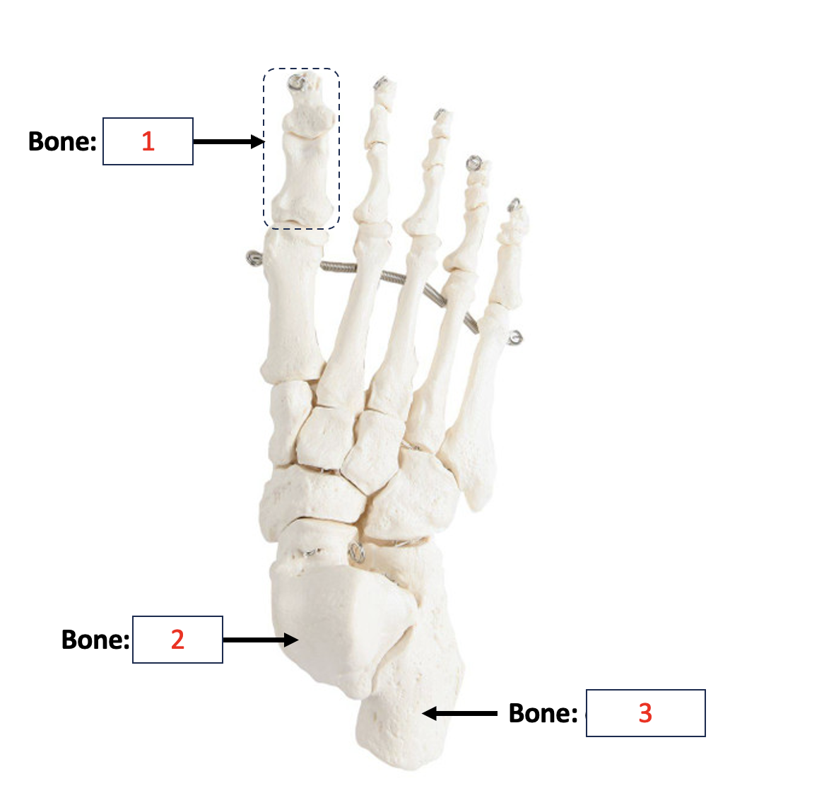 <p>Hallux&nbsp;</p>