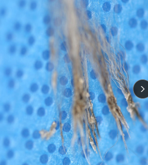 <ul><li><p><strong>Alopecia: </strong>hair loss, partial or complete</p><ul><li><p>Primary or secondary</p></li></ul></li><li><p><strong>Comedone: </strong>dilated follicle filled with keratin/sebum</p><ul><li><p>hormone change / cushings</p></li></ul></li><li><p><strong>Follicular Casts: </strong>keratin &amp; debris around hair shaft at follicle opening</p><ul><li><p>doodles </p></li></ul></li></ul><p></p>