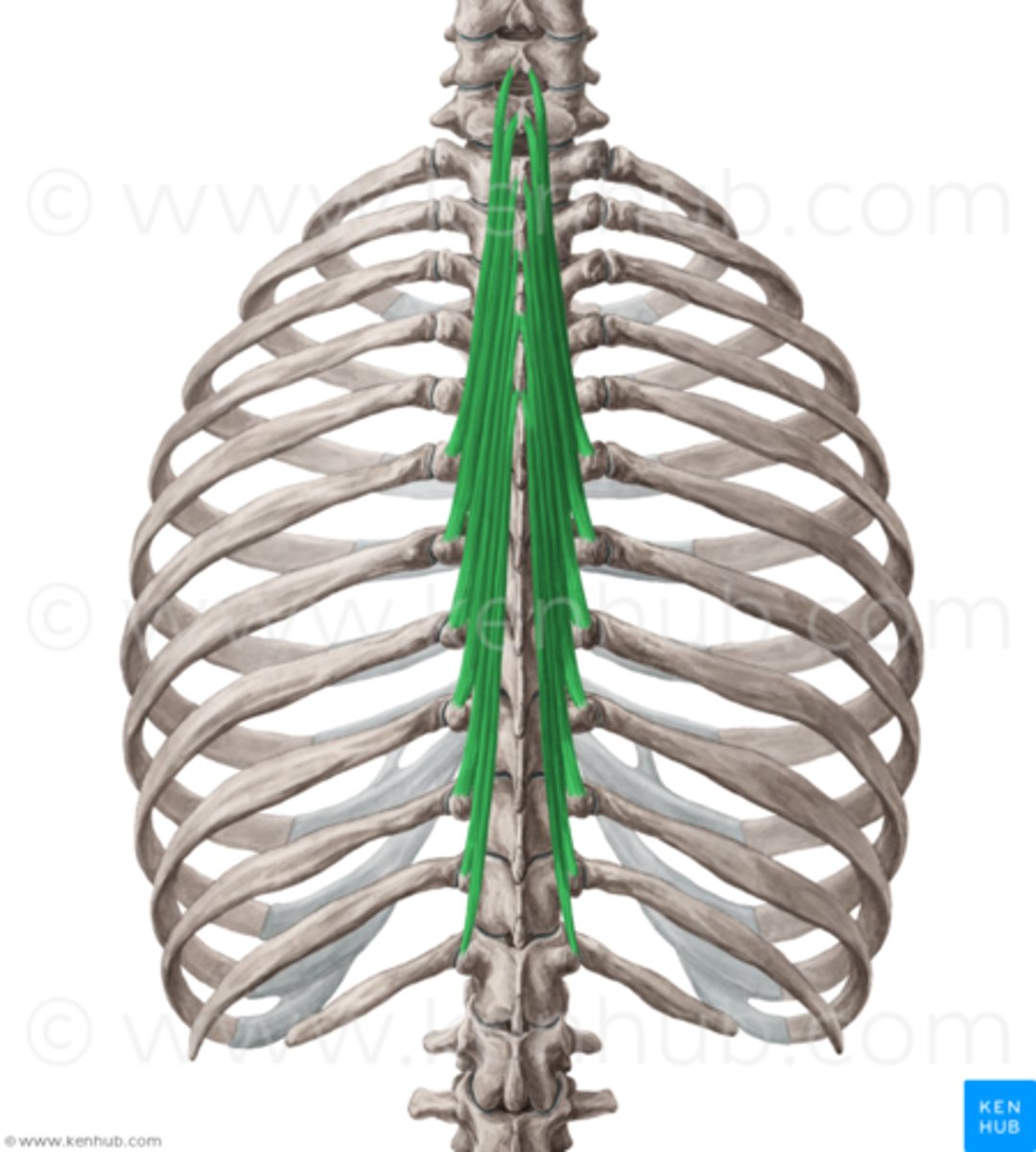 <p>Welke spier is dit?</p>