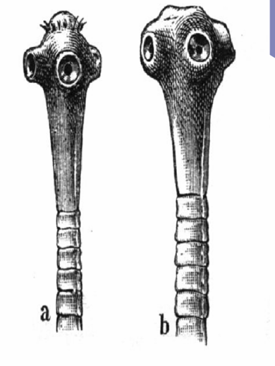 <p><strong>Characteristics of <em>Taenia saginata</em> (Scolex)</strong><br><br>- ______________ unlike in the <em>Taenia solium</em><br>- also have _________ in the scolex<br>- _________ is present posterior to where the suckers are located</p>
