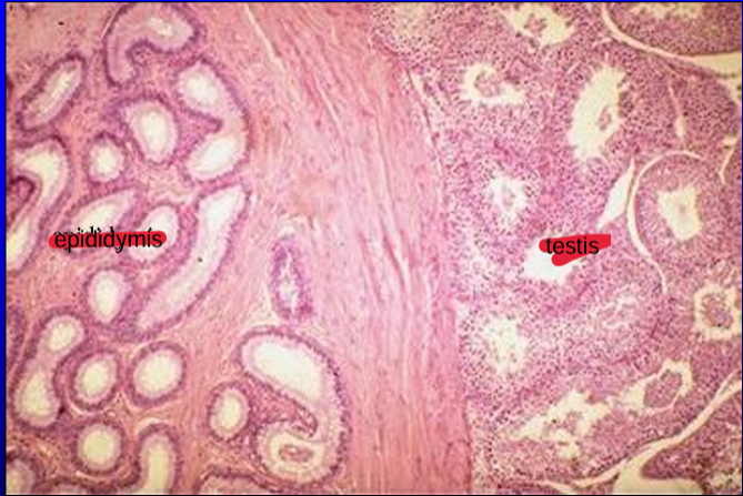 <p>Section of feline testis and epididymis. 20X. </p><p>The testis and the epididymis are separated by the tunica albuginea. </p><p>Notice the difference in the type of epithelium that lines the ducts of the epididymis and the seminiferous tubules of the testis. </p><p>The seminiferous tubules are seen at higher magnifications in the figures that follow</p>