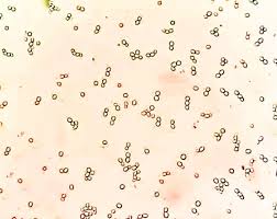 <p>often confused with RBCs</p>