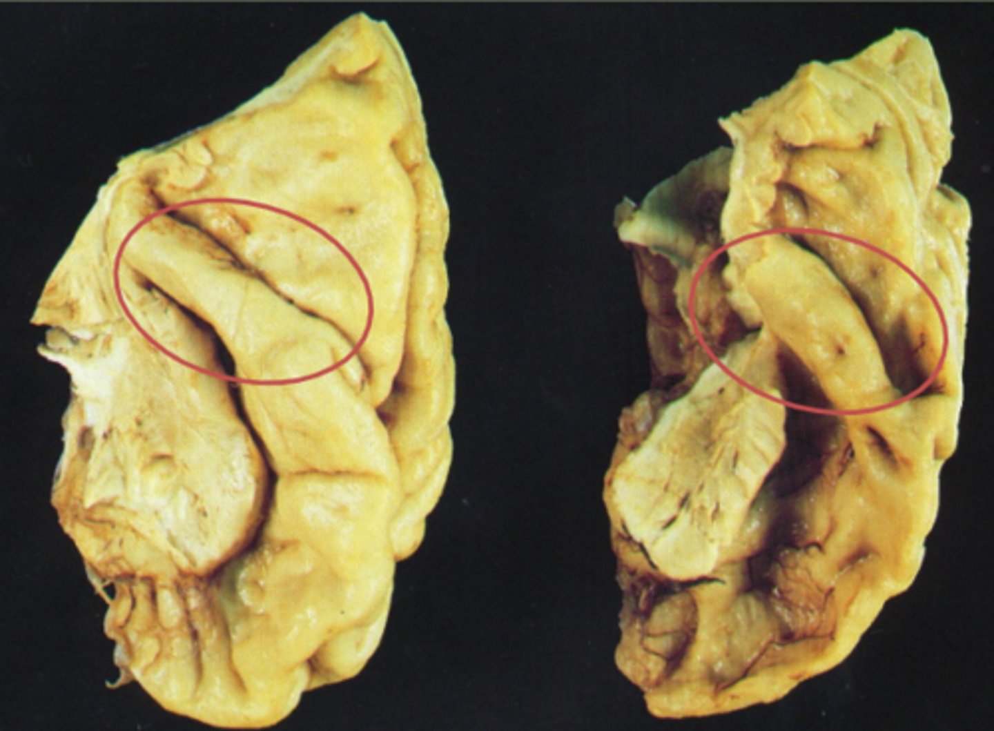 <p>Primary auditory cortex</p>