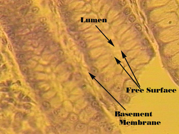 <p>Simple Columnar</p>