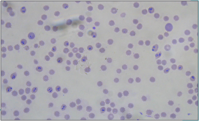 <p>A blood smear from a dog returning to the UK after a summer holiday in the south of France, having collapsed 2 weeks later with acute anaemia.</p><p>What is the parasite?</p>