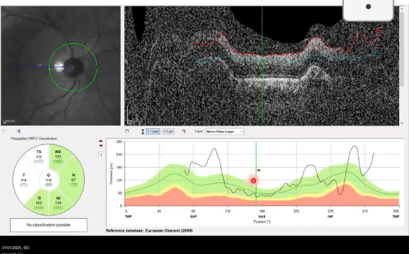 <p>scan capture issues </p>