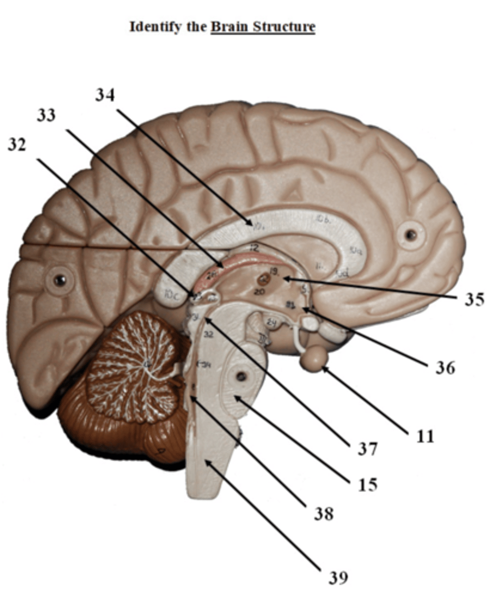 <p>identify the brain structure</p>