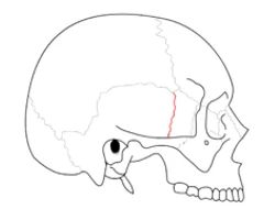 <p>Right lateral view</p>