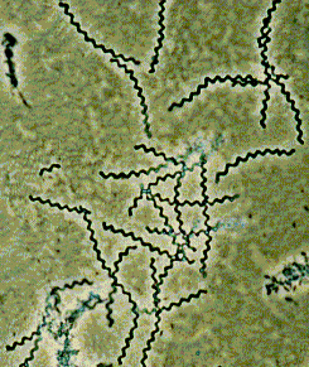 <p>bacteria that are curved, spiral or corkscrew shaped</p>