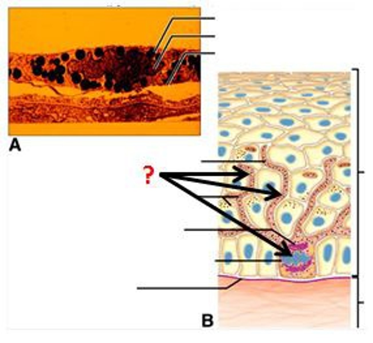 <p>Spidery black cells that produce the brown to black pigment melanin.</p>