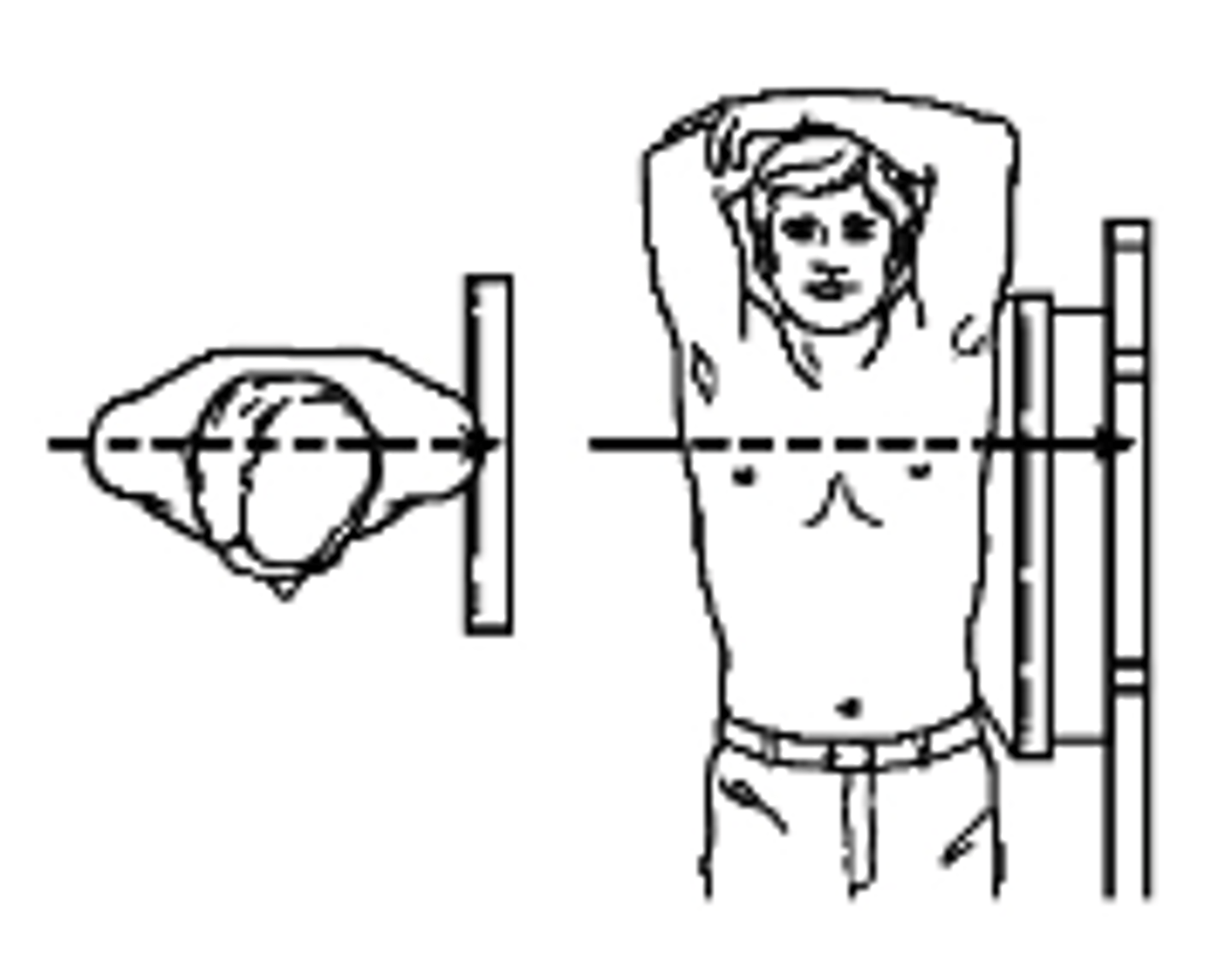 <p>what type of projection is this?</p><p>a. Left lateral</p><p>b. Right Lateral</p><p>c. Left AP Oblique</p><p>c. Right AP Oblique</p>
