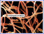 <p>Example of <span>Chlamydoconidium </span></p>