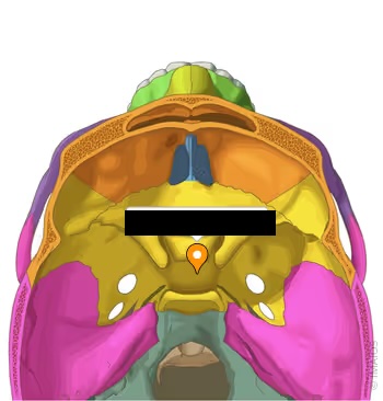 <p>Bottom of sella turcica where the pituitary gland sits (where pointer is)</p>