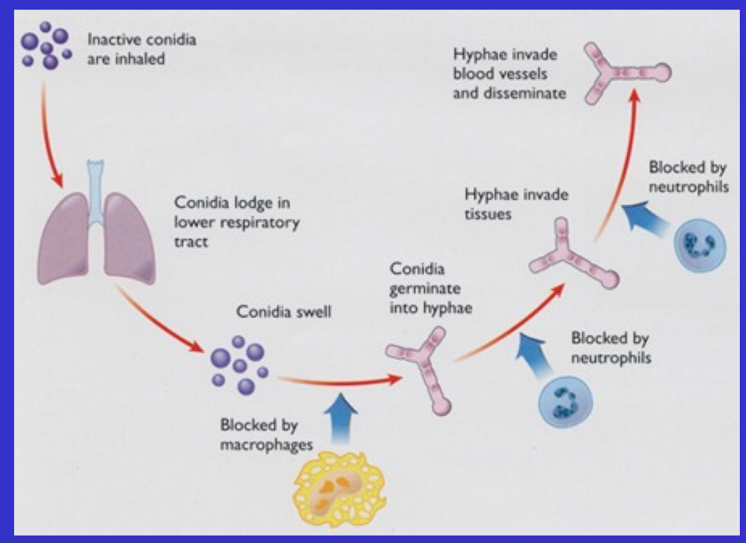 <ul><li><p>Consider that we do not get Aspergillus lung infection despite breathing in spores</p><ul><li><p>Hyphae WANT to invade blood vessels and disseminate</p></li><li><p>Macrophages block transition of spore into hyphae</p></li><li><p>AND they can block hyphae invading tissue</p></li><li><p>AND they can block hyphae invading the blood vessels</p></li><li><p><strong>WHICH IS WHY THIS IS DISEASE OF IMMUNOCOMPROMISED PATIENTS</strong></p></li></ul></li></ul><p></p>