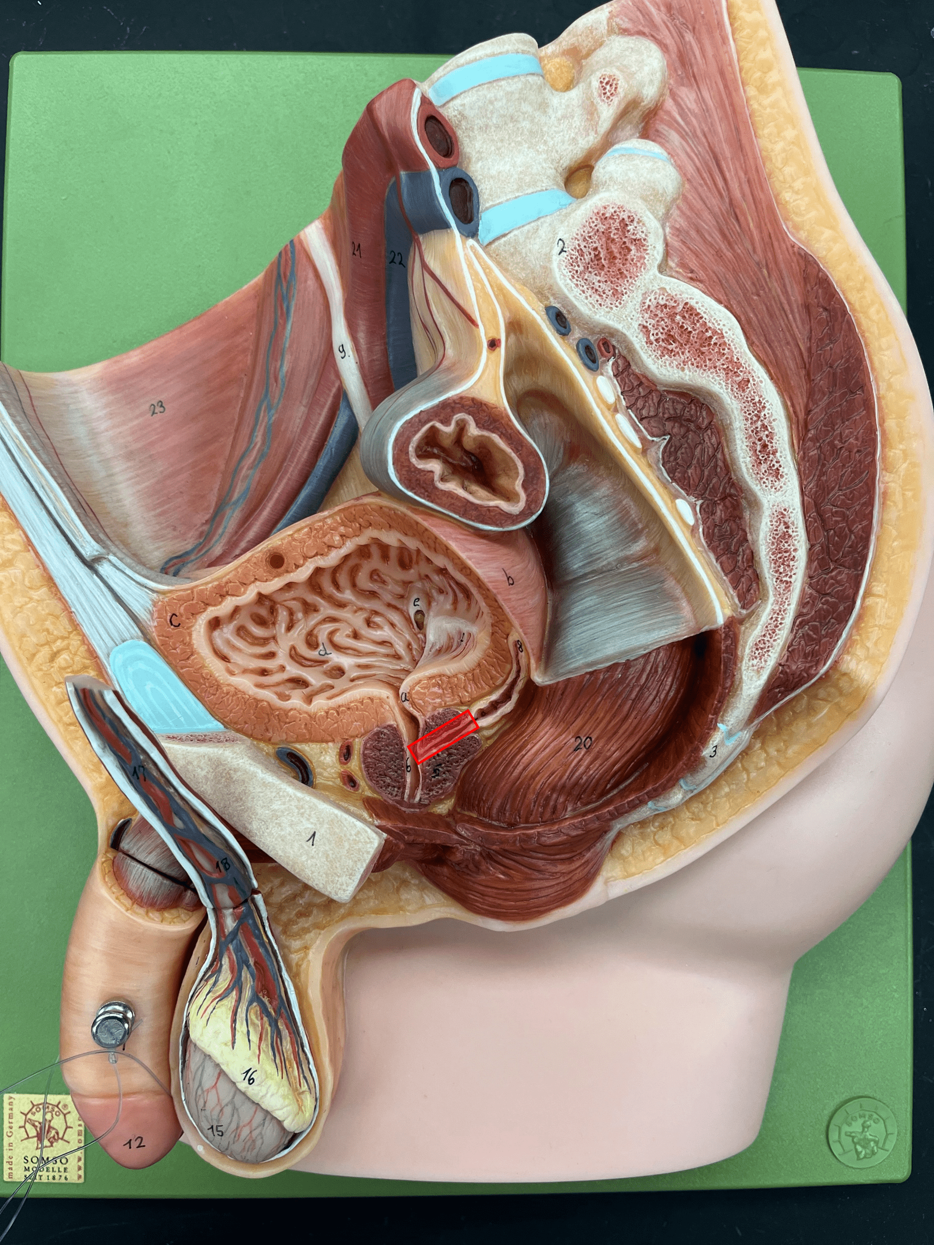 • Part of the male duct network.

• The convergence of the ampulla of the ductus deferens and the seminal vesicle duct.

• Merges with the other into the urethra.